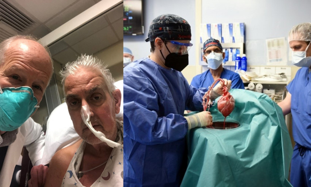 US Man Survives After Having Heart Transplant From A Pig!